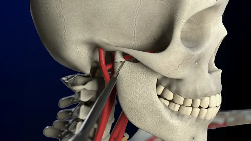 ORTHOGNATHIC SURGERY